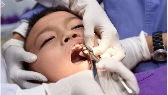 What Are the Complications of a Tooth Removal