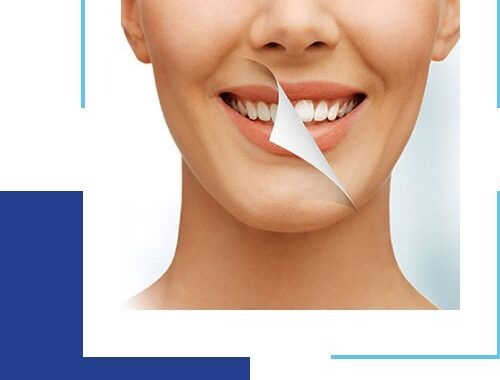 Mistakes People Make When Getting Teeth Whitening Treatment