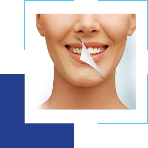 Mistakes People Make When Getting Teeth Whitening Treatment