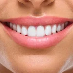 The Benefits of Choosing a Dedicated Hollywood Smile Clinic