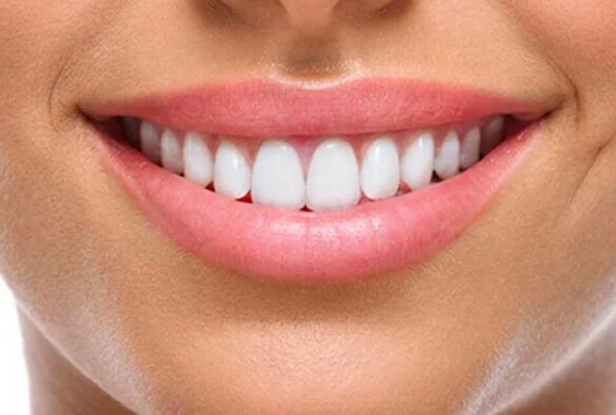 The Benefits of Choosing a Dedicated Hollywood Smile Clinic